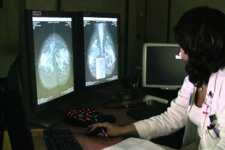 Screening mammografici