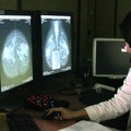 Potenziare lo screening sul tumore mammario