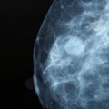 Attualità e Prospettive della Terapia Medica del Carcinoma Mammario
