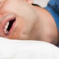 Apnee notturne: Approccio multidisciplinare nella diagnosi e terapia dell’OSAS