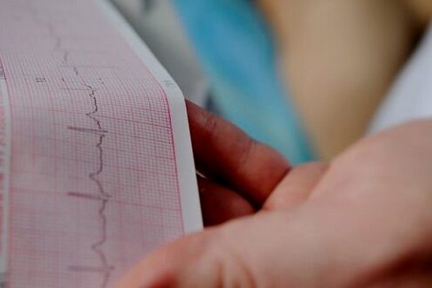 Telemedicina elettrocardiogramma