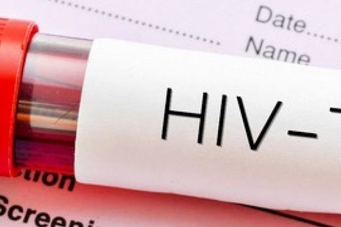 Test rapido HIV